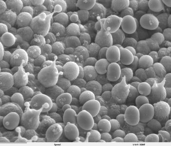 Esporas del hongo Agaricus bisporus brotando. Imagen de microscopio electrónico de barrido.